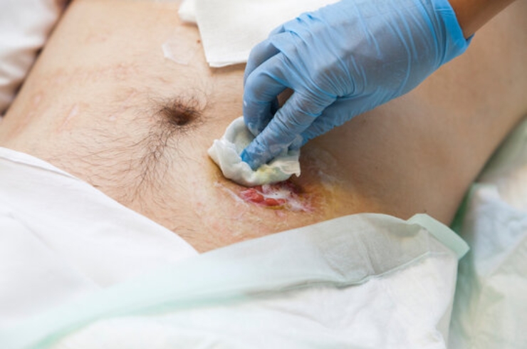 Colorectal Surgery