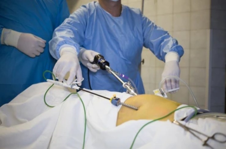 Endosurgery--------14